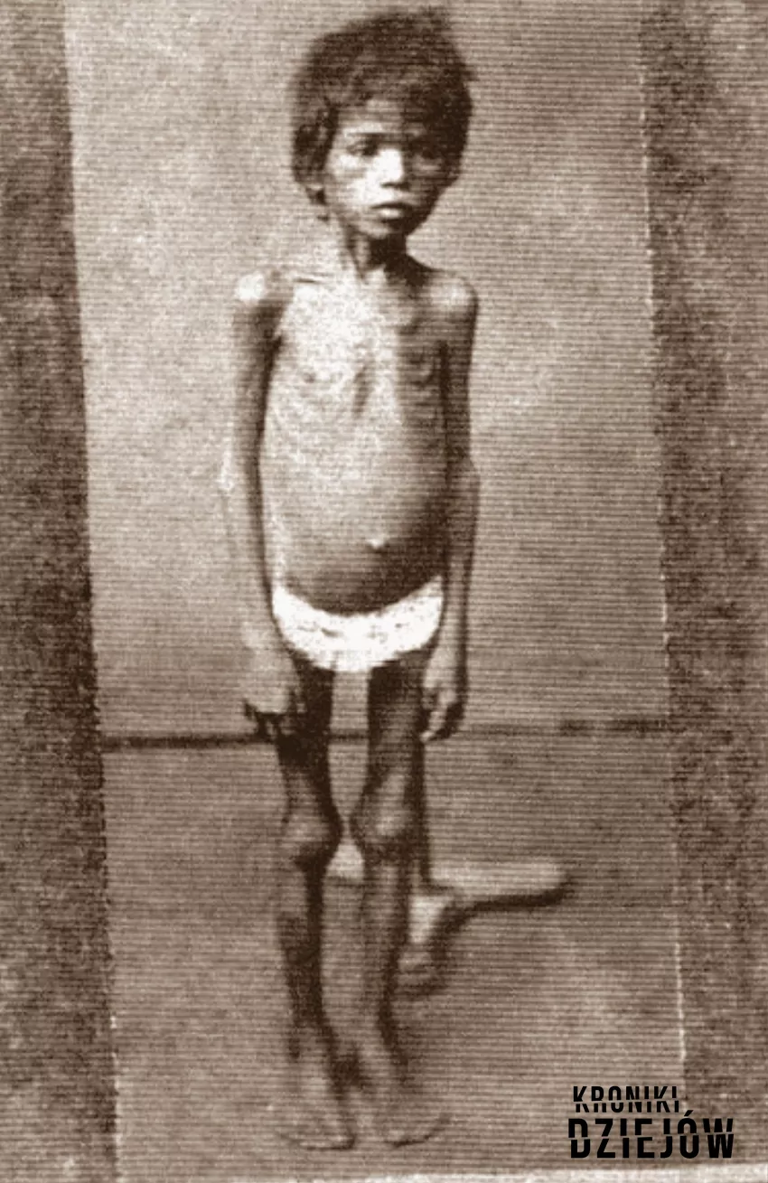 Niedożywione dziecko podczas wielkiej suszy (Grande Seca) w Brazylii (1877), fot. domena publiczna/Wikipedia Niedożywione dziecko podczas wielkiej suszy (Grande Seca) w Brazylii (1877)